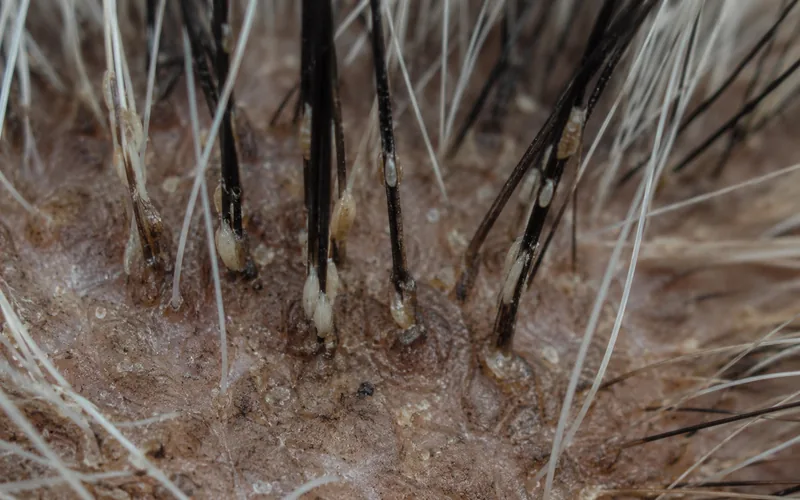 Magnified view of louse nits cemented to goat hair shafts near the skin